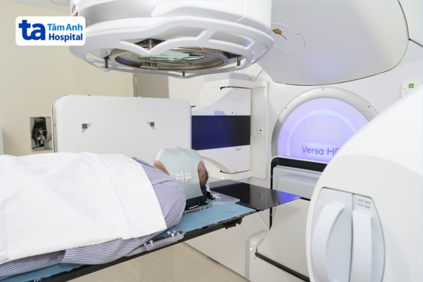 xạ phẫu điều trị các tổn thương trong sọ như u não, dị dạng mạch máu và di căn não