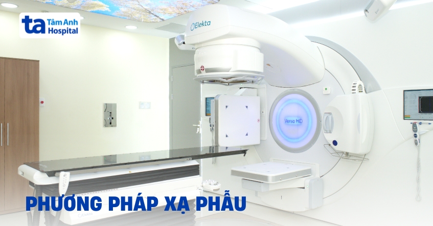 Thông tin chi tiết về phương pháp điều trị xạ phẫu