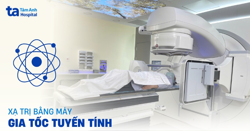 Phương pháp xạ trị bằng máy gia tốc tuyến tính