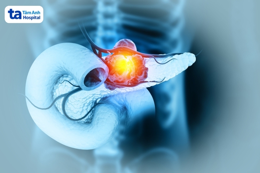 xạ trị thường được dùng kết hợp với phẫu thuật và hóa trị