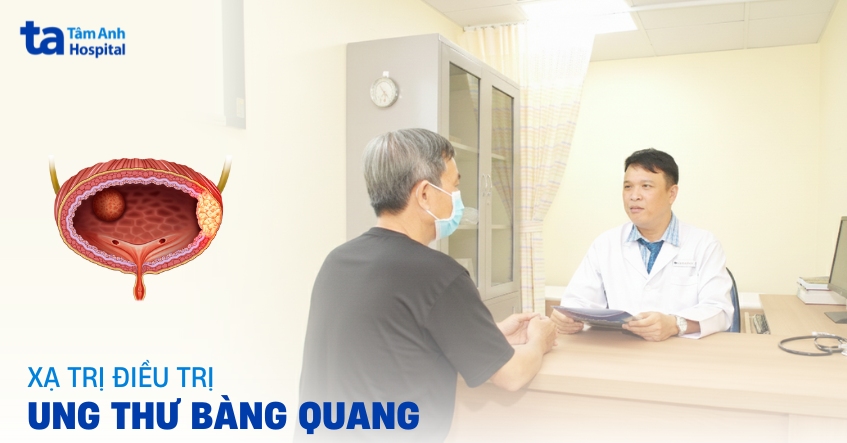 Có nên xạ trị điều trị ung thư bàng quang không?