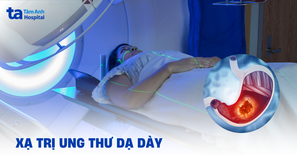 Ung thư dạ dày có phải xạ trị không?