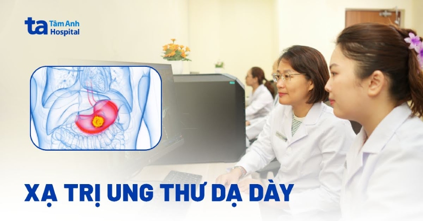 Ung thư dạ dày có phải xạ trị không?