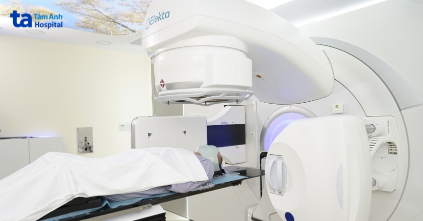 xạ trị ung thư hạ họng bệnh tại bvđk tâm anh tp.hcm