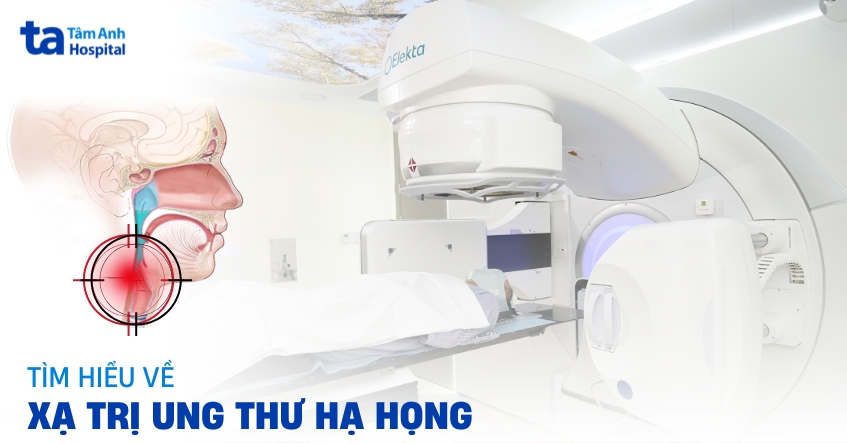 Tìm hiểu về xạ trị ung thư hạ họng