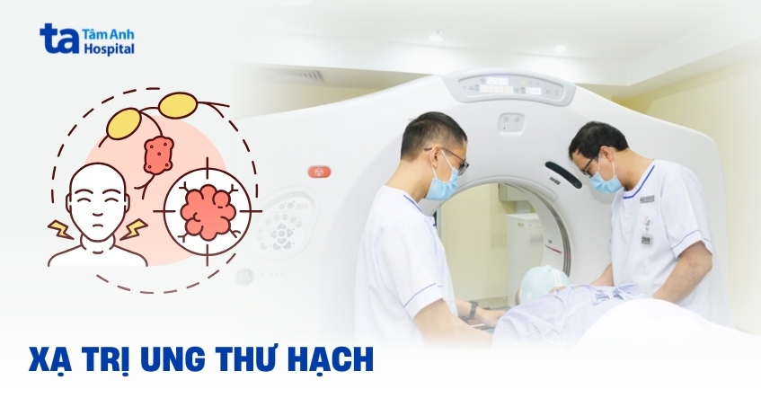 Mục tiêu của xạ trị ung thư hạch