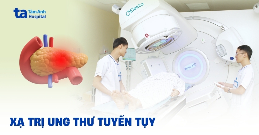 Bạn biết gì về xạ trị ung thư tuyến tụy?