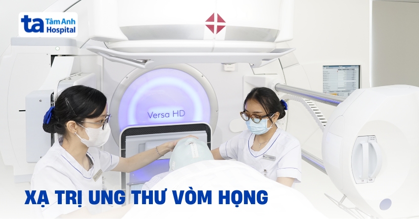 Thời gian xạ trị ung thư vòm họng là bao lâu?