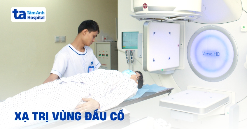 Xạ trị vùng đầu cổ có ảnh hưởng gì không?