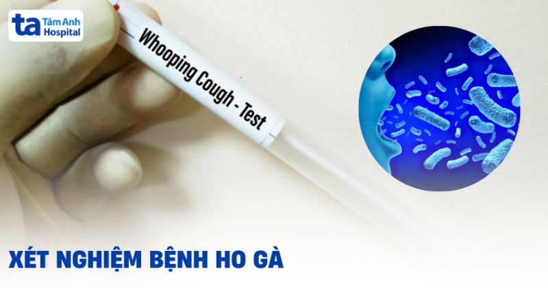 Các phương pháp xét nghiệm ho gà phổ biến và chính xác