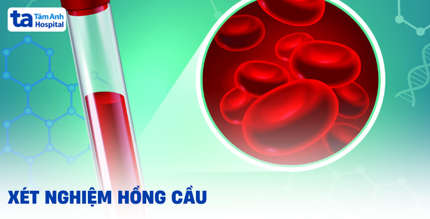 Ý nghĩa xét nghiệm hồng cầu trong máu bạn cần biết
