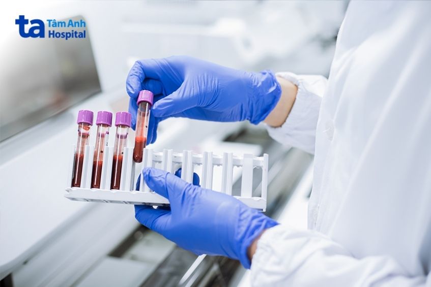 xét nghiệm máu chẩn đoán bệnh