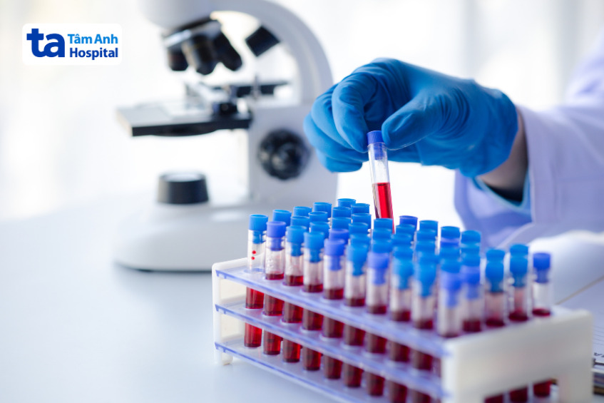 xét nghiệm máu chẩn đoán bệnh Polycythemia