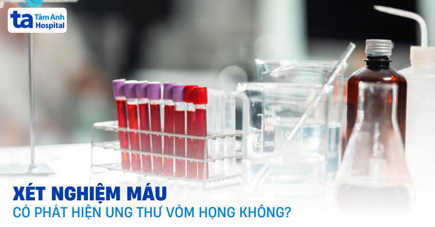 Xét nghiệm máu có phát hiện ung thư vòm họng không?