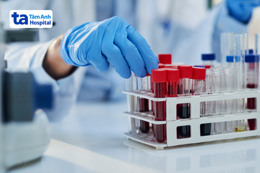 xét nghiệm máu định kỳ giúp phát hiện sớm các rối loạn sản xuất hồng cầu trong cơ thể