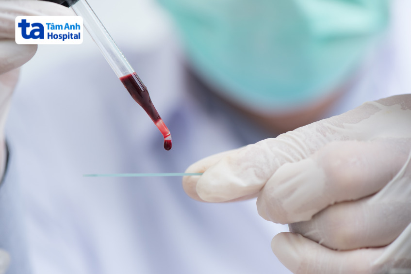 xét nghiệm máu toàn phần