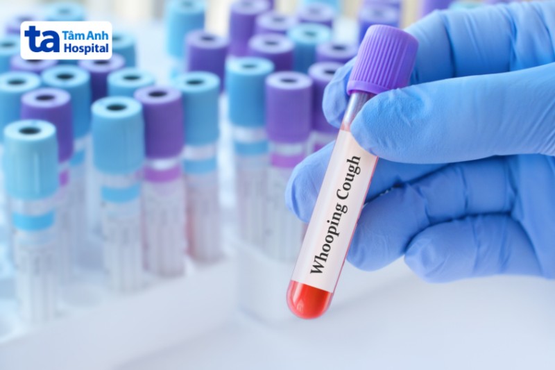 xét nghiệm máu phát hiện bệnh ho gà