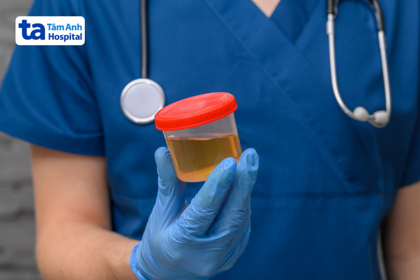 xét nghiệm nước tiểu tổng quát