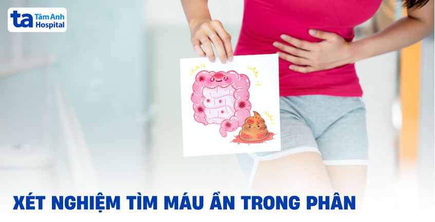 Xét nghiệm tìm máu ẩn trong phân – Hồng cầu trong phân
