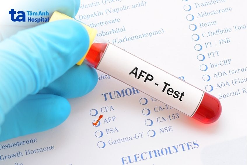 xét nghiệm ung thư gan bằng nhiều phương pháp