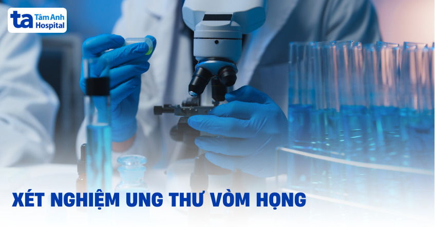 Xét nghiệm ung thư vòm họng cần làm những gì?