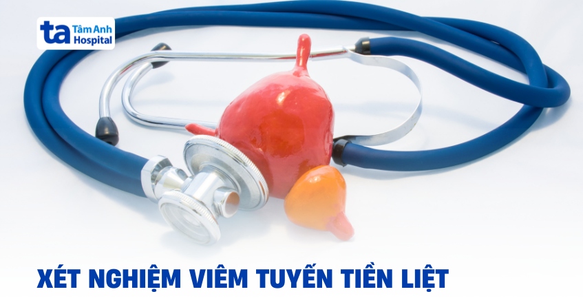 Xét nghiệm viêm tuyến tiền liệt cần chuẩn bị những gì?