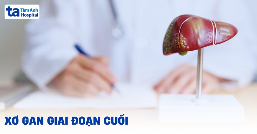 Xơ Gan Giai Đoạn Cuối