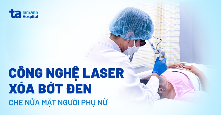 Công nghệ Laser xóa bớt đen che nửa mặt người phụ nữ