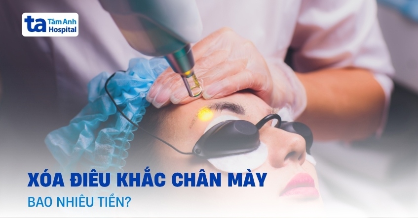 Giải đáp: Xóa điêu khắc lông mày bao nhiêu tiền?