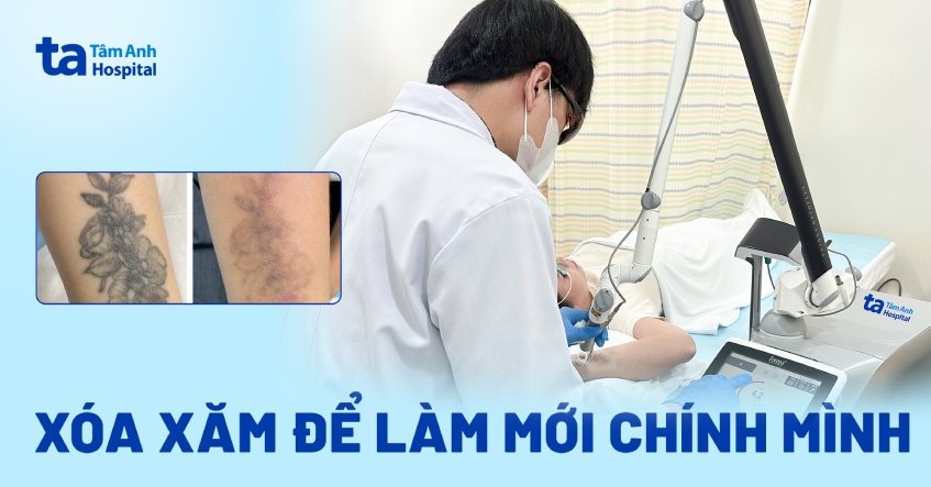Xóa xăm để làm mới chính mình