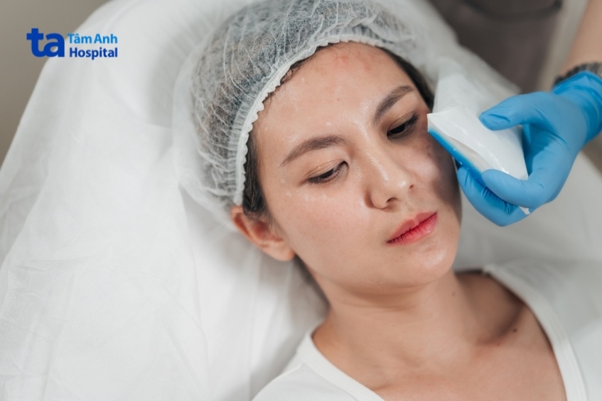 xử lý sưng mặt nhẹ khi peel da tại nhà