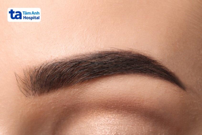 yếu tố ảnh hưởng đến chi phí xóa laser chân mày