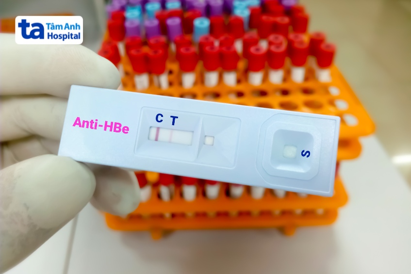 anti hbe âm tính
