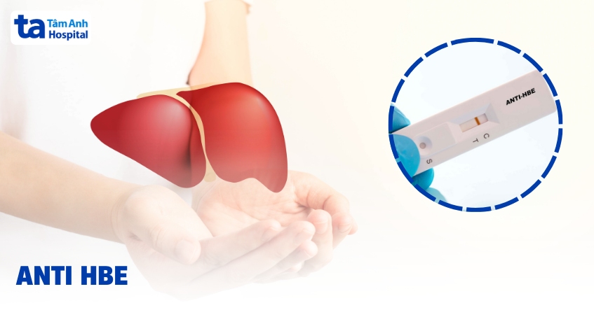 Anti HBe: Khi nào cần xét nghiệm và ý nghĩa kết quả?