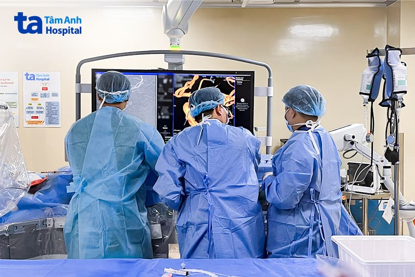 bác sĩ hoàn (trái) cùng êkip tiến hành đặt stent thay đổi dòng chảy điều trị túi phình mạch máu não cho người bệnh