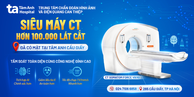 banner siêu máy ct 100000 lát cắt mb