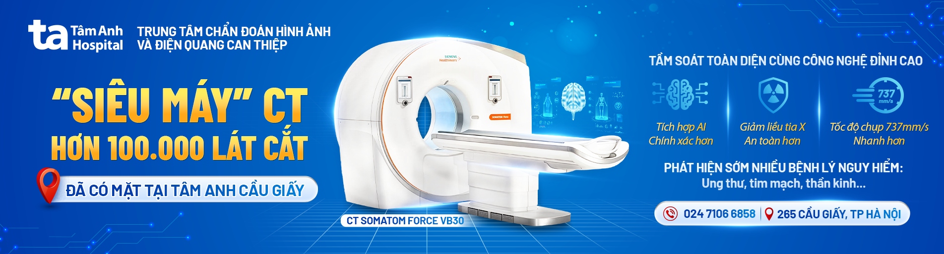 banner siêu máy CT 100.000 lát cắt pc