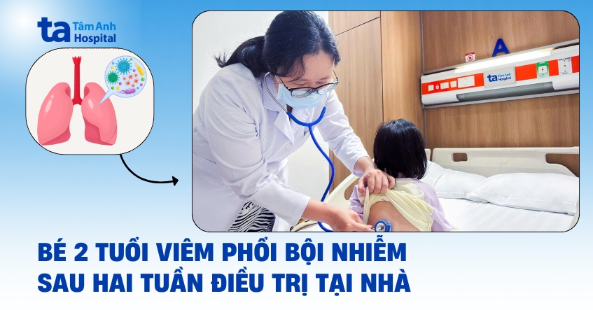 Bé 2 tuổi viêm phổi bội nhiễm sau 2 tuần tự điều trị tại nhà