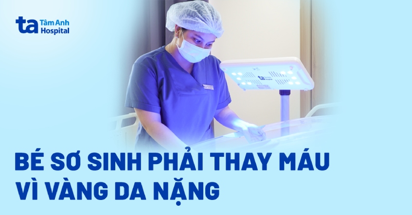 Bé sơ sinh phải thay máu vì vàng da nặng