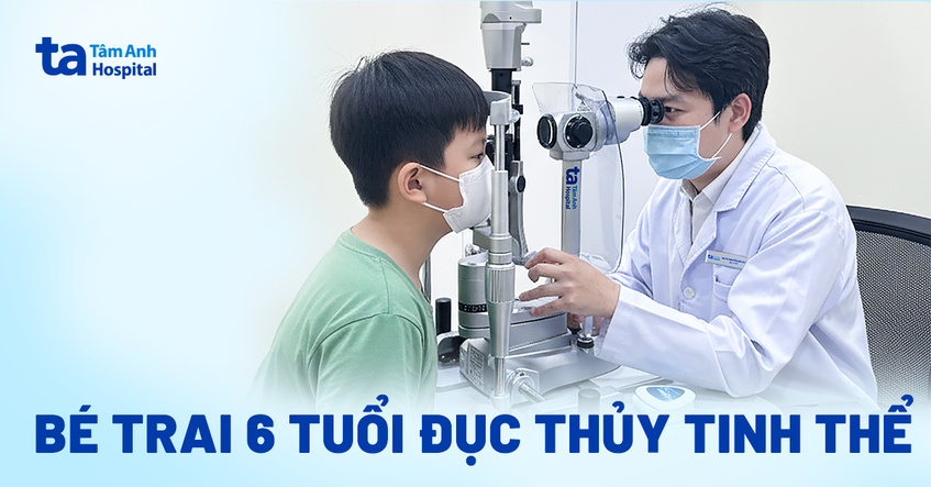 Bé trai 6 tuổi đục thủy tinh thể