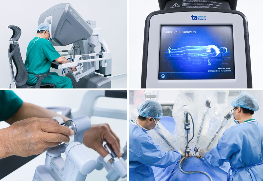 bệnh viện tâm anh ứng dụng robot da vinci xi trong hơn 120 loại phẫu thuật