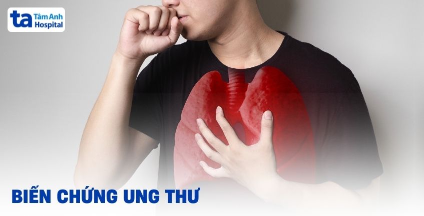 Các biến chứng ung thư nhiều nguy hiểm khôn lường
