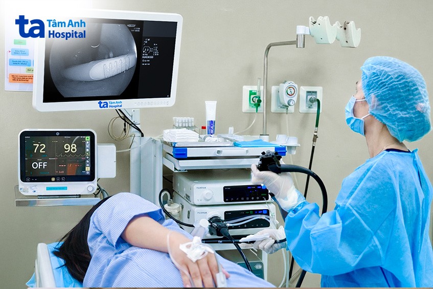 BS Thủy nội soi gấp dị vật