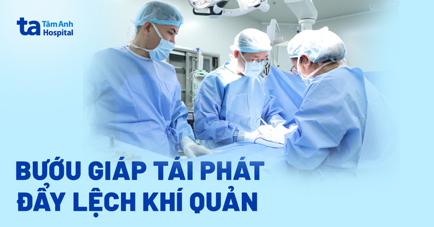 Bướu giáp tái phát sau 30 năm