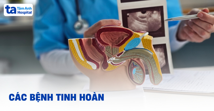 Các bệnh tinh hoàn thường gặp ở nam giới phổ biến hiện nay