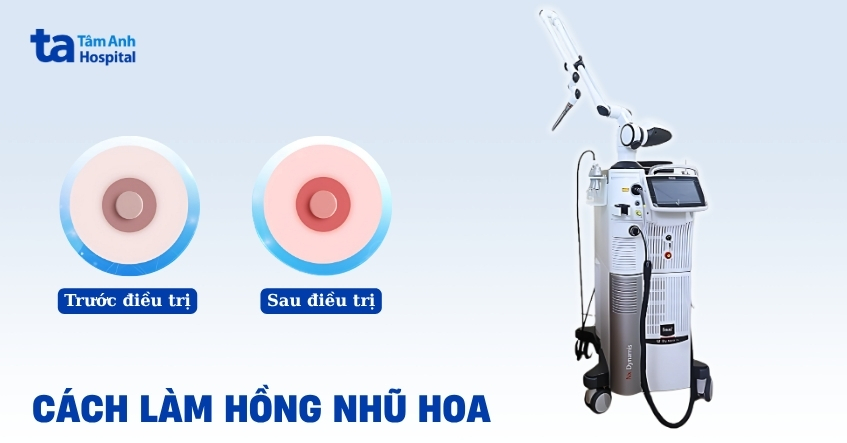 5 cách làm hồng nhũ hoa an toàn và hiệu quả dành cho chị em