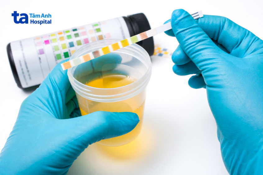 chẩn đoán ung thư niệu quản