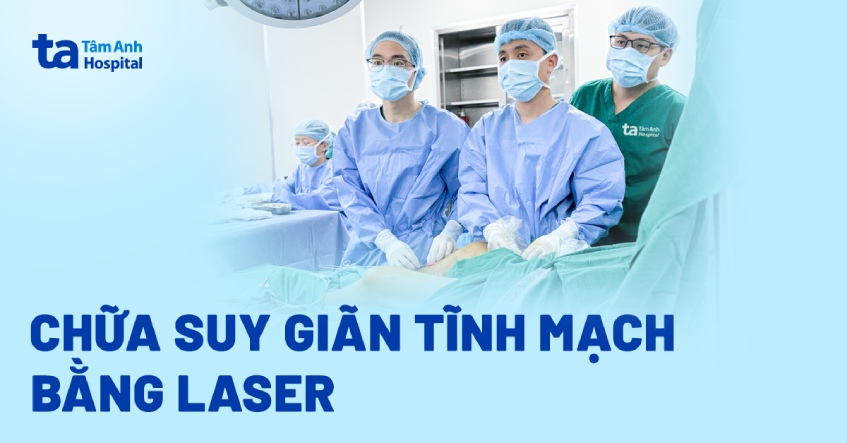 Dùng laser cứu đôi chân suy giãn tĩnh mạch nhiều năm