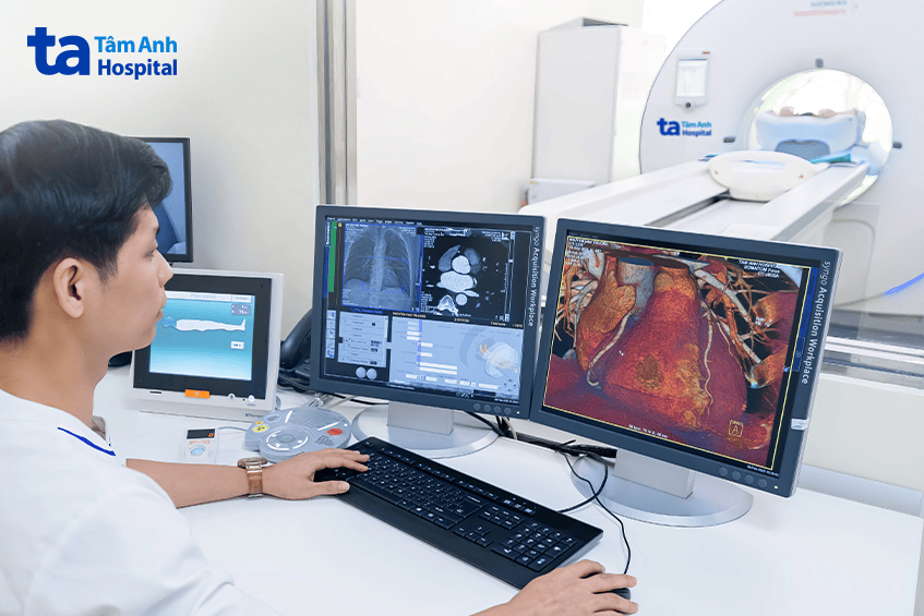 chụp tầm soát lồng ngực cho người bệnh bằng hệ thống CT Somatom Force VB30 tại Bệnh viện Đa khoa Tâm Anh TP.HCM (cơ sở P.Tân Hưng - Q.7 cũ)