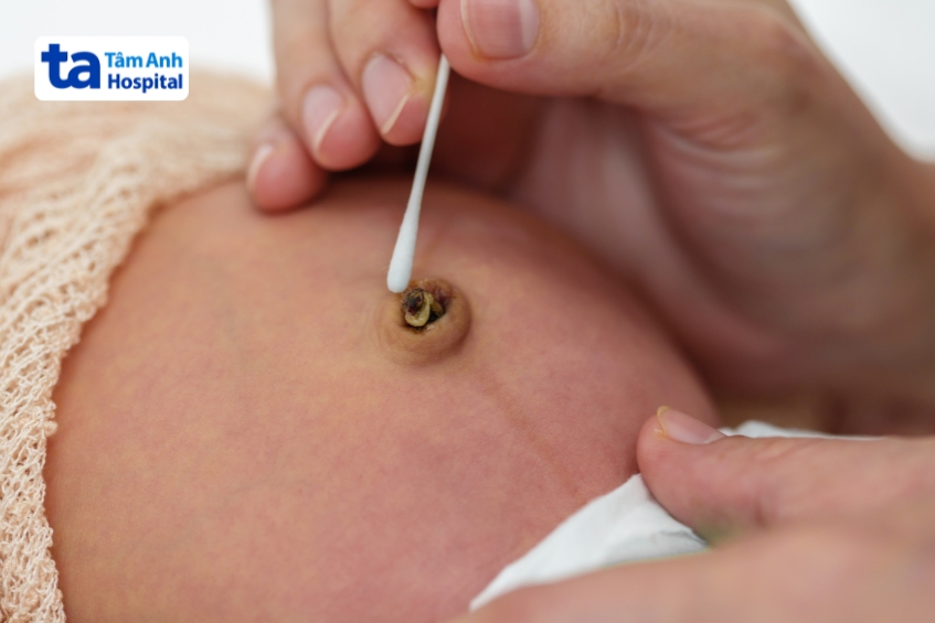 cuống rốn của trẻ sẽ khô lại và rụng đi theo thời gian